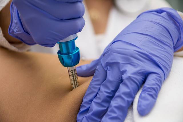 Renova | Intradermoterapia Pressurizada