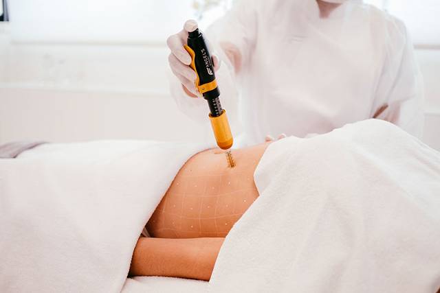 Renova | Lipo Química